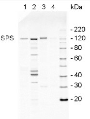 SPS | Sucrose phosphate synthase, global in the group Antibodies Plant/Algal / Global Antibodies at Agrisera AB (Antibodies for research) (AS03 035A)